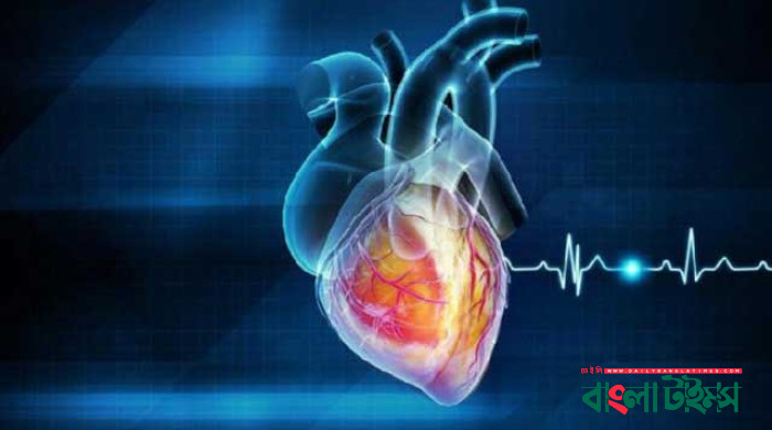 ডলার সংকটে পেসমেকার আমদানিতে জটিলতা