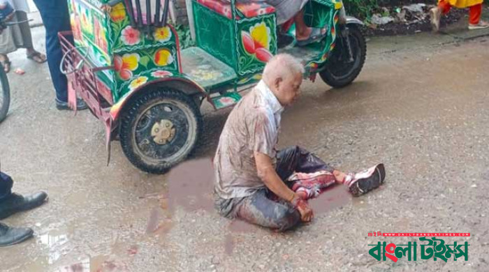 নাটোরে সমাবেশে হামলা : বিএনপি নেতা ও রাসিক সাবেক মেয়র বুলবুল আহত