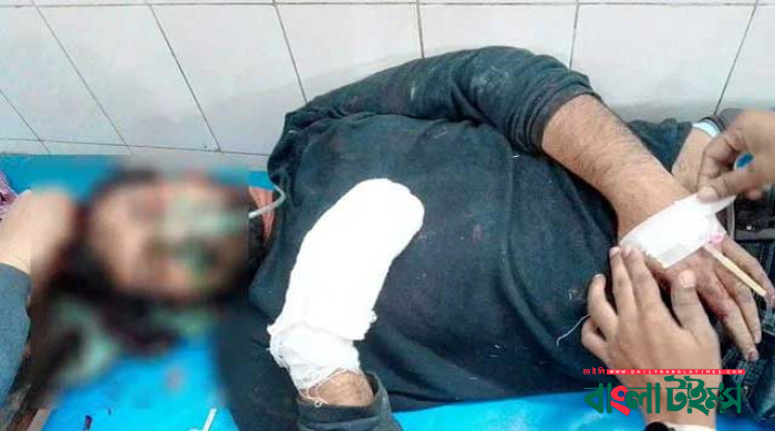 রায়পুরায় আসামি ধরতে গিয়ে হামলায় র‌্যাব সদস্যের তিন আঙুল বিচ্ছিন্ন