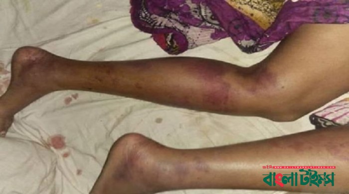 Woman gang-raped for voting for her choice