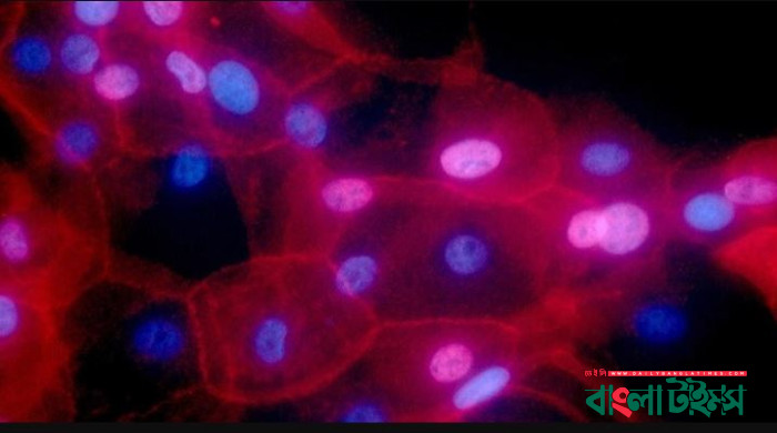 New device able to detect cancer cells without surgery