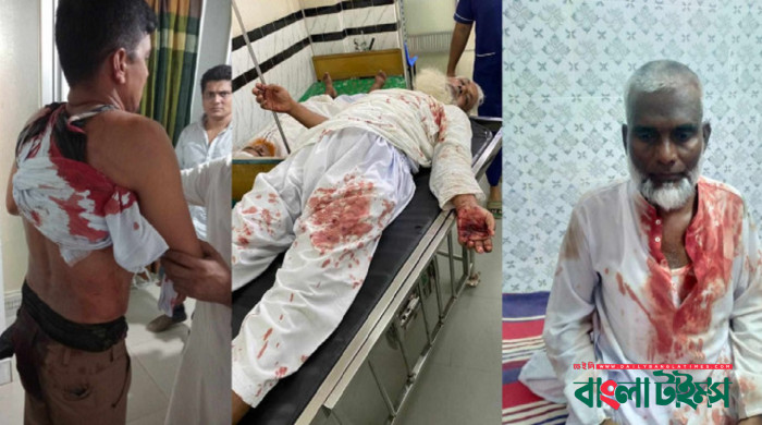 60 hurt as BNP convoy attacked in Cumilla