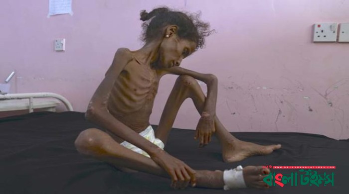 This is what our Yemen policy looks like